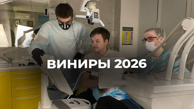 Как устанавливают керамические виниры